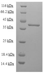 Recombinant Toxocara canis 26KDA secreted antigen(TES-26)