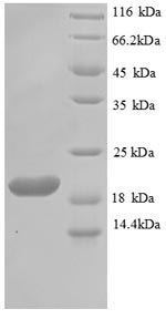 Recombinant Toxoplasma gondii Profilin(PRF)