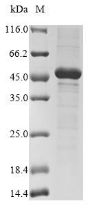 Recombinant Trypanosoma cruzi Cruzipain