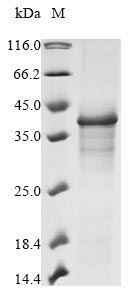 Recombinant Varicella-zoster virus Envelope glycoprotein H(gH),partial