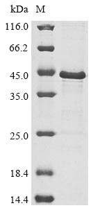 Recombinant Vesicular stomatitis Indiana virus Phosphoprotein(P)
