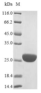 Recombinant Vesicular stomatitis Indiana virus RNA-directed RNA polymerase L(L),partial