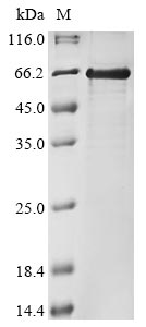 Recombinant Xenopus laevis Polyribonucleotide 5'-hydroxyl-kinase Clp1(clp1)