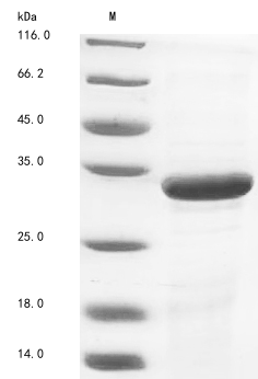Recombinant Zaire ebolavirus Matrix protein VP40(VP40)