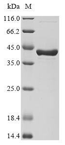Recombinant chimeric Dpo4 [synthetic construct]