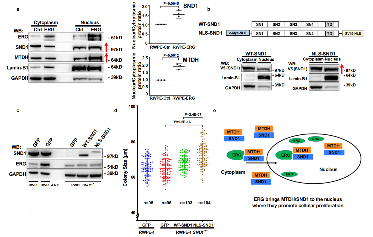SND1: potential prostate cancer target SND1: potential prostate cancer target