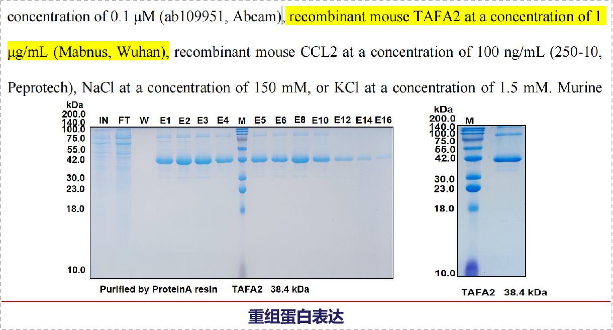 Sour neuronal signalling attenuates macrophage mediated liver injury