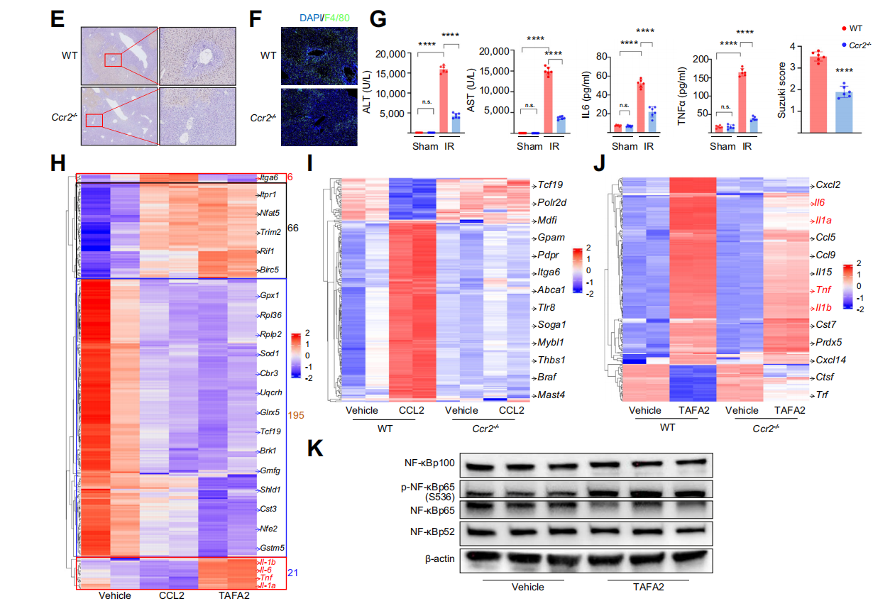 Sour neuronal signalling attenuates macrophage mediated liver injury