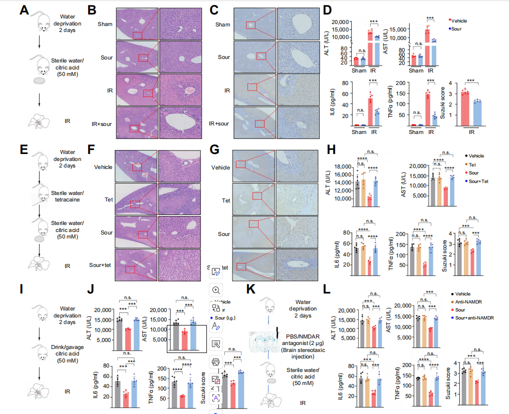 Sour neuronal signalling attenuates macrophage mediated liver injury