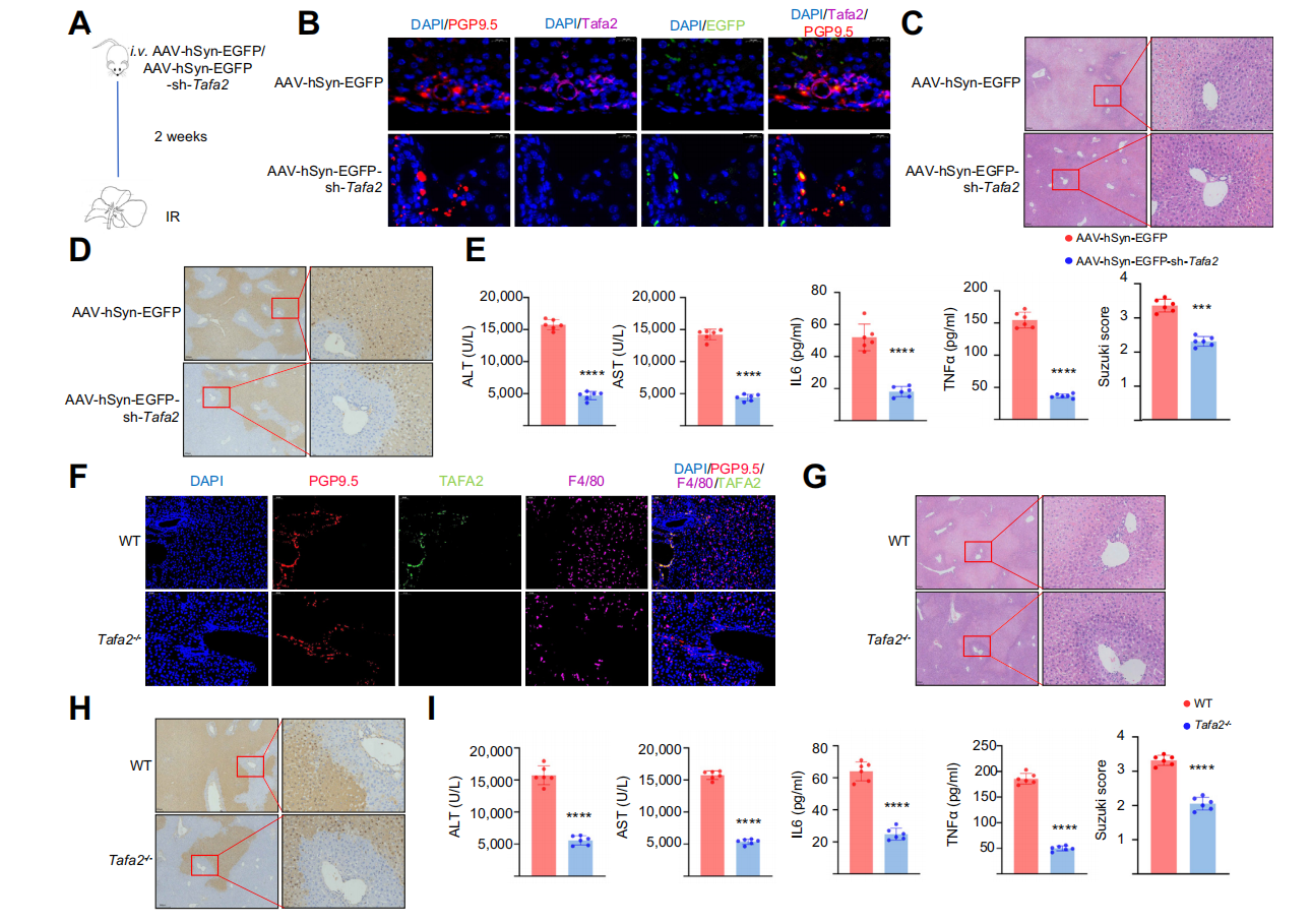 Sour neuronal signalling attenuates macrophage mediated liver injury