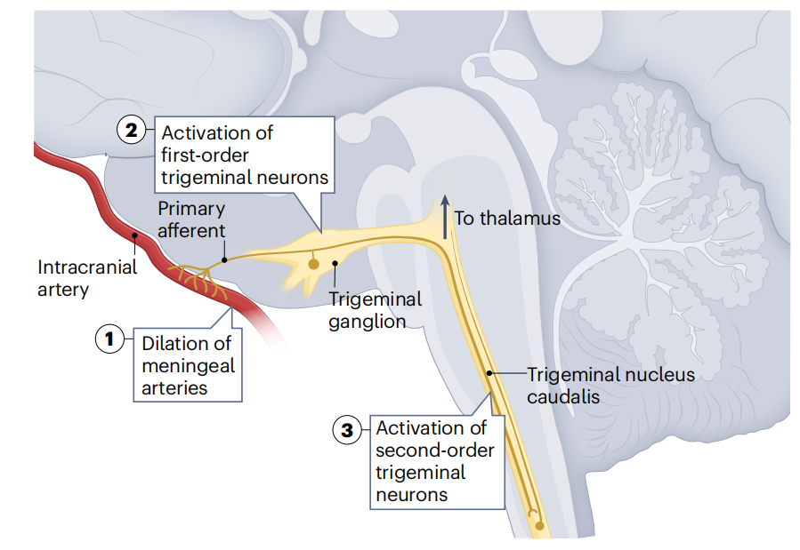 Target for migraine treatment ADCYAP1
