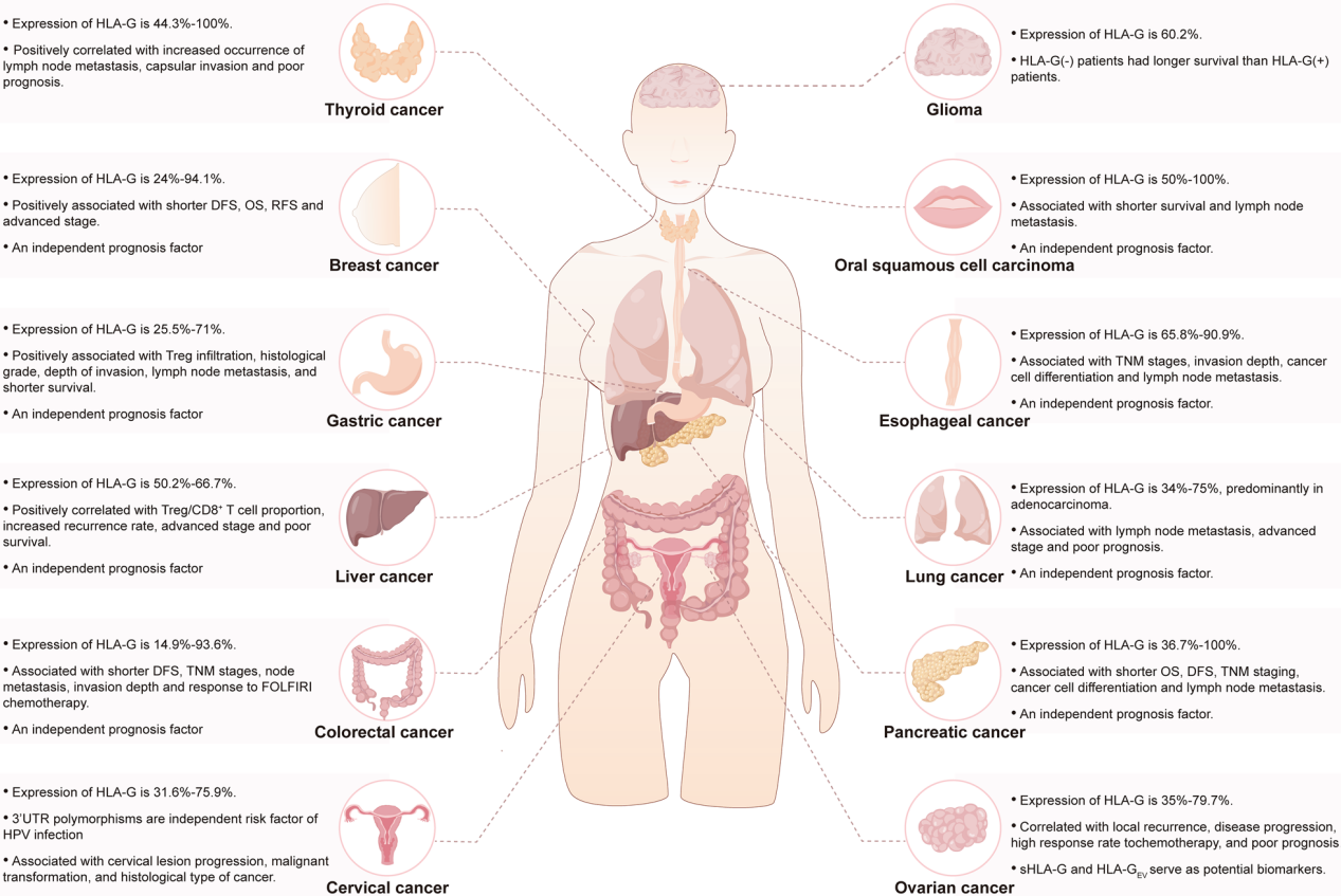 Tumor immune escape therapy target HLAG