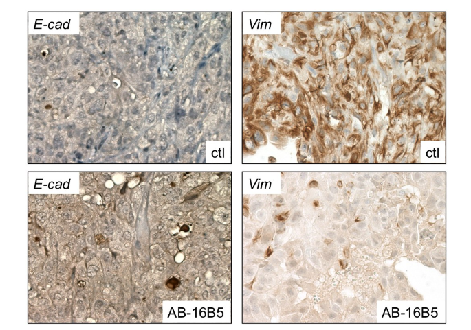 Tumor microenvironment homeostasis regulator CLU Tumor microenvironment homeostasis regulator CLU