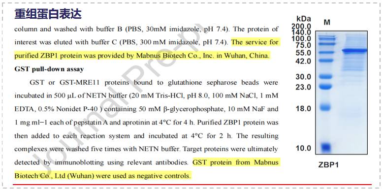 ZBP1 can antagonize the DNA end excision mediated by MRE11 ZBP1 can antagonize the DNA end excision mediated by MRE11