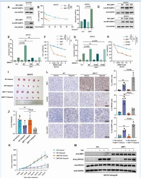 ZBP1 can antagonize the DNA end excision mediated by MRE11 ZBP1 can antagonize the DNA end excision mediated by MRE11