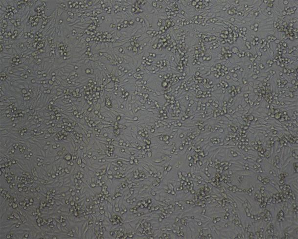 HEK细胞表达服务 HEK细胞表达服务